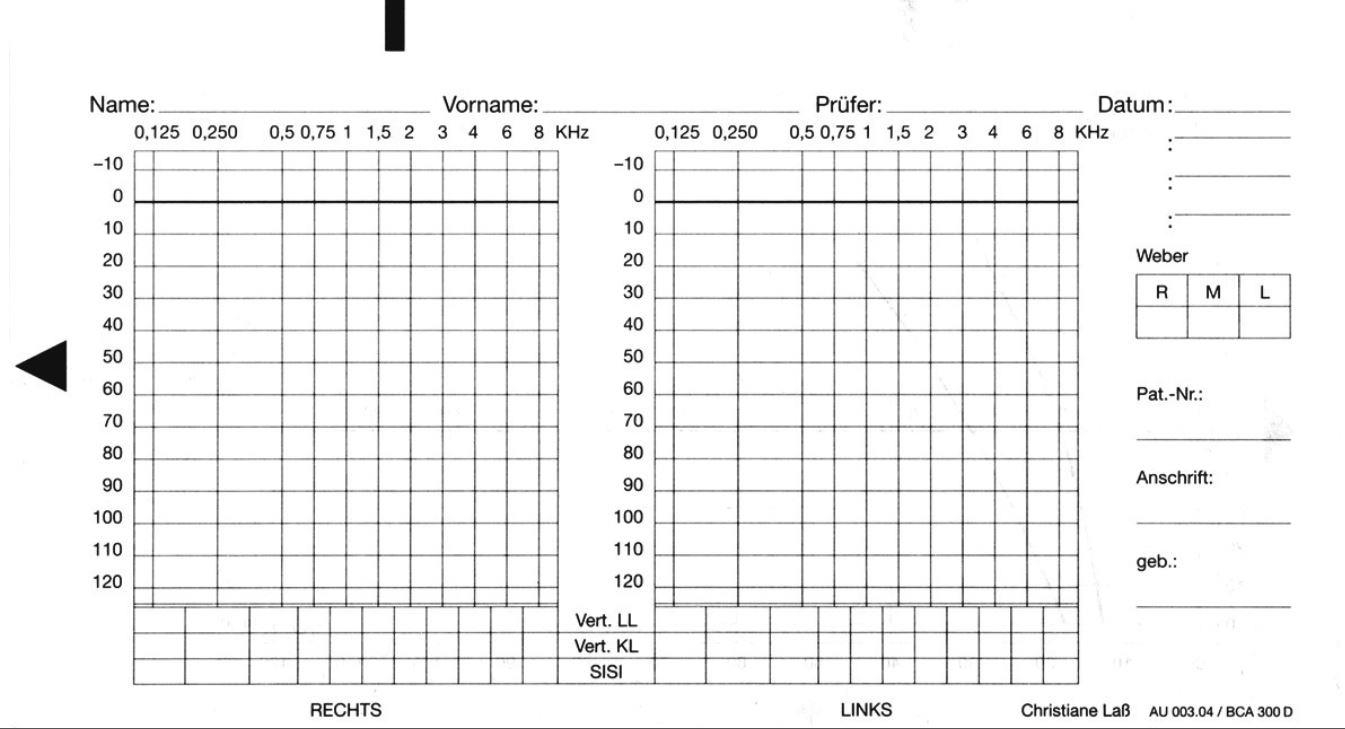 Printable Blank Audiogram Form